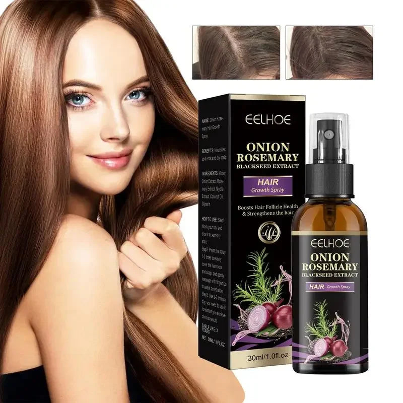 Rosevera™ Premium Onion & Rosemary Hair Growth Elixir – 30ml