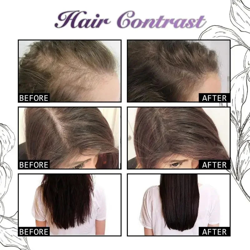 Rosevera™ Premium Onion & Rosemary Hair Growth Elixir – 30ml