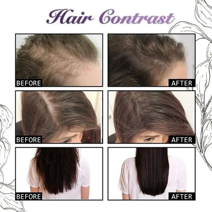 Rosevera™ Premium Onion & Rosemary Hair Growth Elixir – 30ml