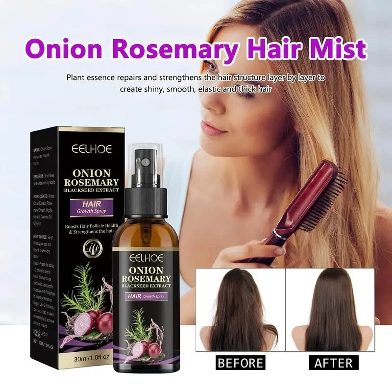 Rosevera™ Premium Onion & Rosemary Hair Growth Elixir – 30ml