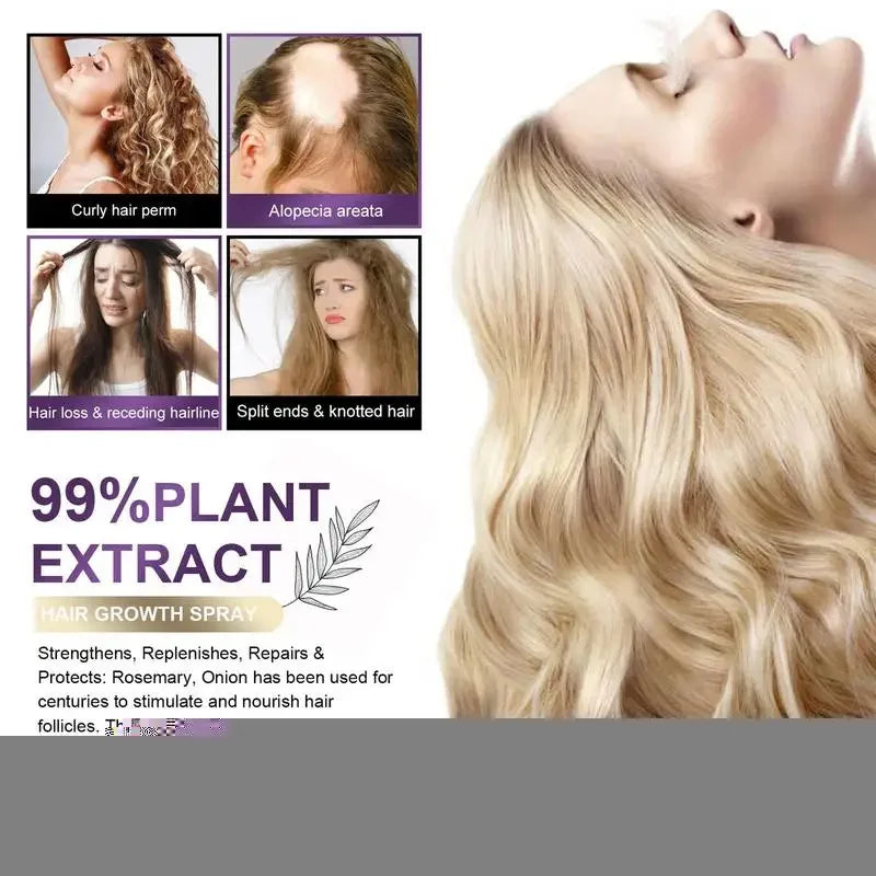Rosevera™ Premium Onion & Rosemary Hair Growth Elixir – 30ml